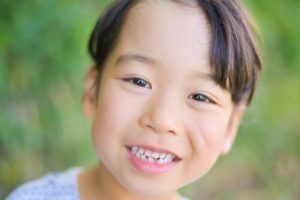 欧米では矯正が当たり前なのでしょうか？